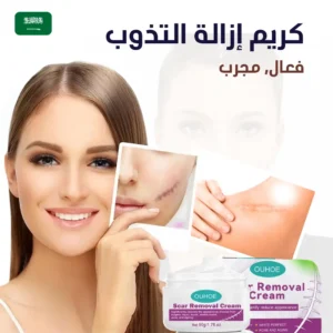 كريم إزالة النذوب
