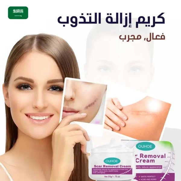 كريم إزالة النذوب